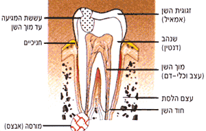 חתך אורך של שן