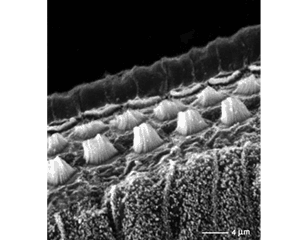 תאי השערות במיקרוסקופ אלקטרונים סורק